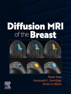 cover image of DIFFUSION MRI OF THE BREAST, E-Book